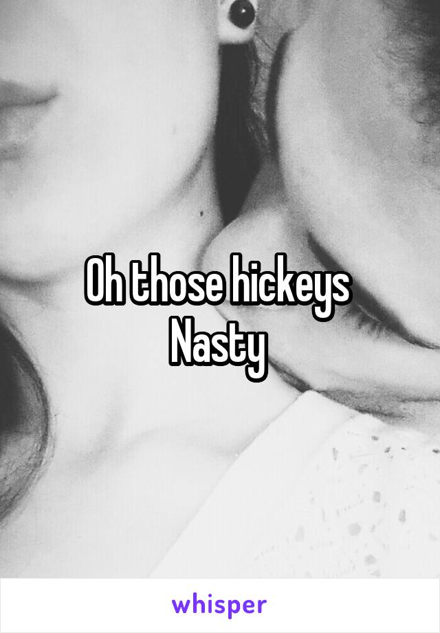 Oh those hickeys 
Nasty 