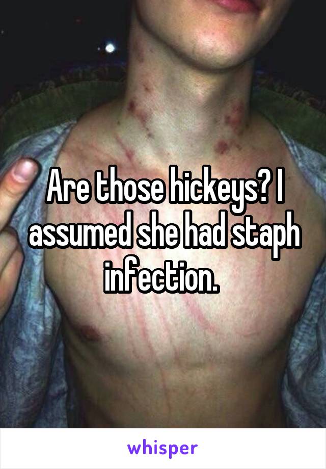 Are those hickeys? I assumed she had staph infection. 