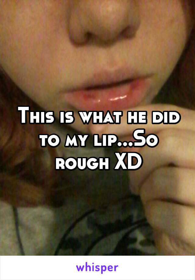 This is what he did to my lip...So rough XD