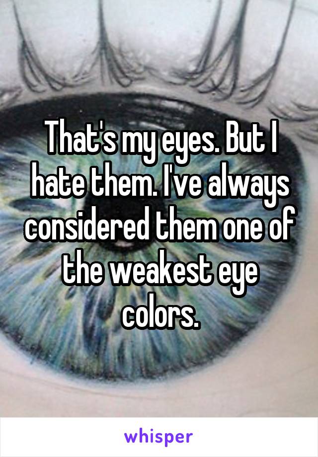 That's my eyes. But I hate them. I've always considered them one of the weakest eye colors.