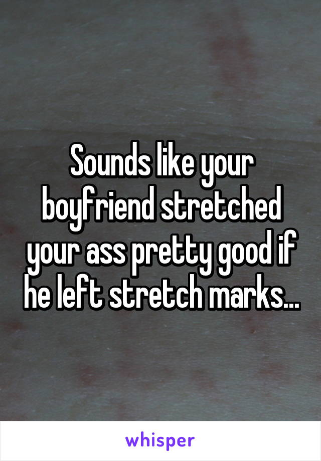 Sounds like your boyfriend stretched your ass pretty good if he left stretch marks...
