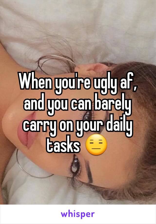 When you're ugly af, and you can barely carry on your daily tasks 😑