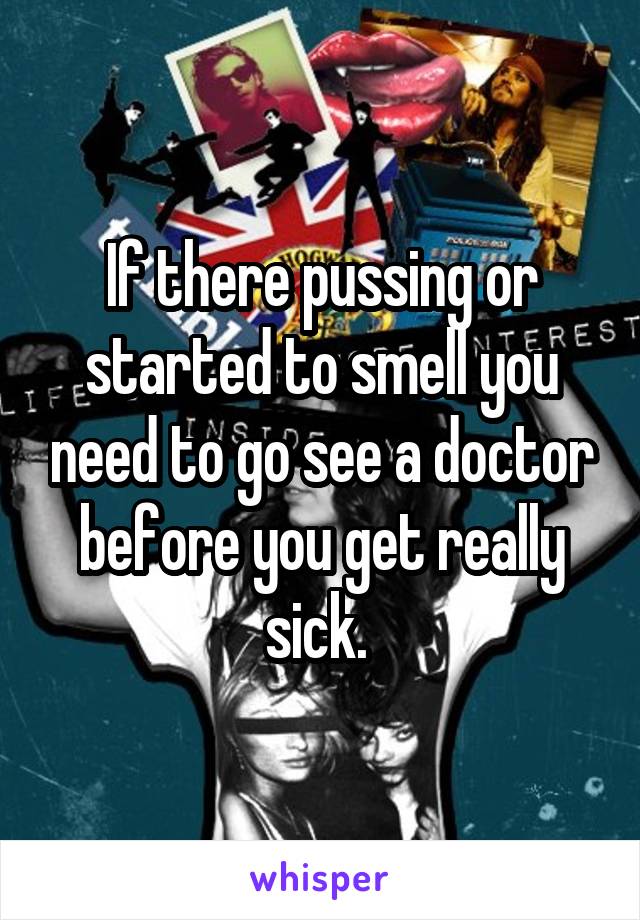 If there pussing or started to smell you need to go see a doctor before you get really sick. 