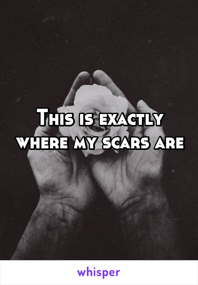 This is exactly where my scars are 