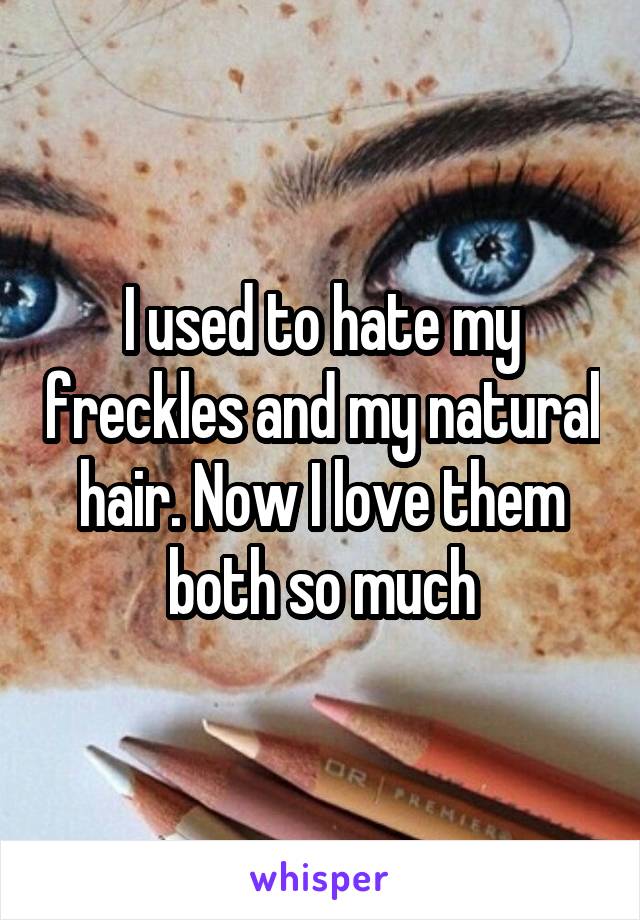 I used to hate my freckles and my natural hair. Now I love them both so much
