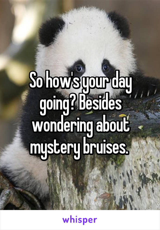 So how's your day going? Besides wondering about mystery bruises. 