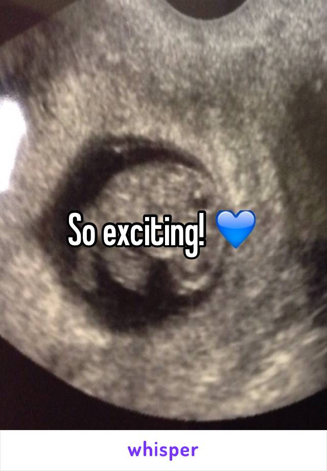 So exciting! 💙