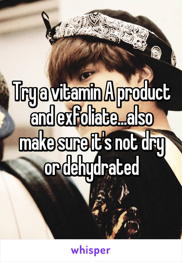 Try a vitamin A product and exfoliate...also make sure it's not dry or dehydrated