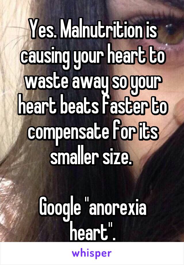 Yes. Malnutrition is causing your heart to waste away so your heart beats faster to compensate for its smaller size. 

Google "anorexia heart".