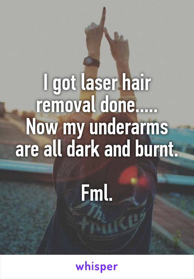 I got laser hair removal done.....
Now my underarms are all dark and burnt.

Fml.