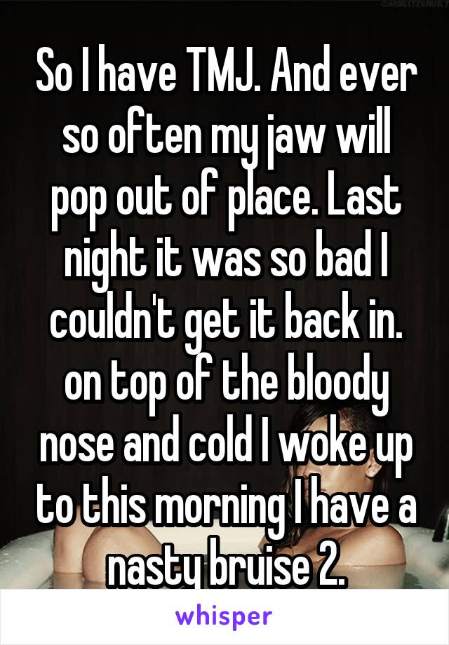 So I have TMJ. And ever so often my jaw will pop out of place. Last night it was so bad I couldn't get it back in. on top of the bloody nose and cold I woke up to this morning I have a nasty bruise 2.