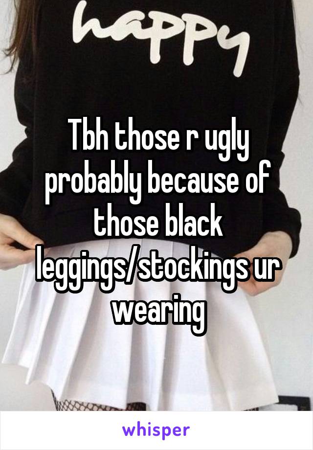 Tbh those r ugly probably because of those black leggings/stockings ur wearing