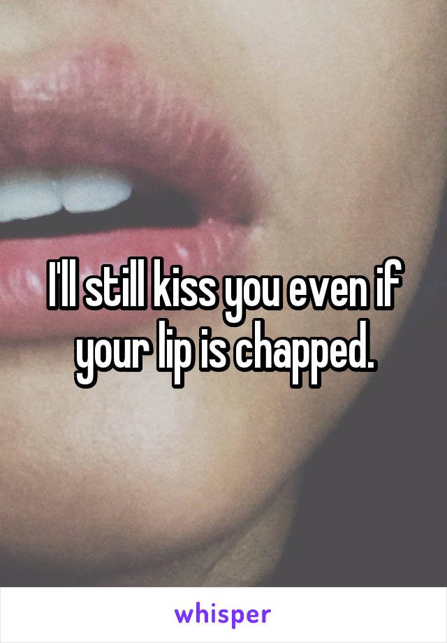 I'll still kiss you even if your lip is chapped.