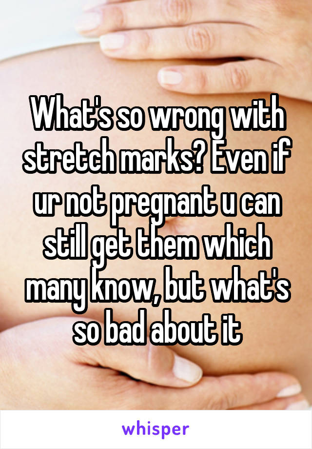 What's so wrong with stretch marks? Even if ur not pregnant u can still get them which many know, but what's so bad about it