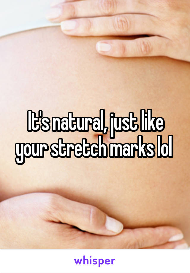 It's natural, just like your stretch marks lol 