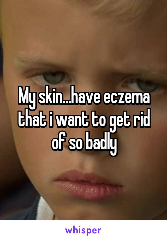 My skin...have eczema that i want to get rid of so badly