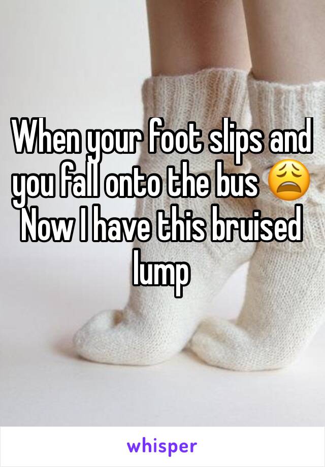 When your foot slips and you fall onto the bus 😩 Now I have this bruised lump 