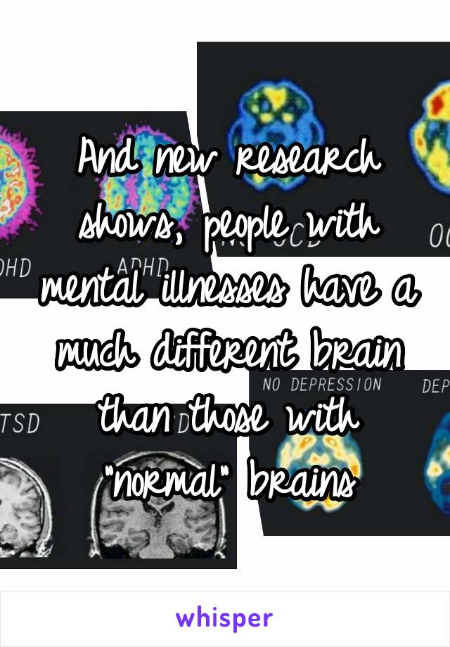 And new research shows, people with mental illnesses have a much different brain than those with "normal" brains