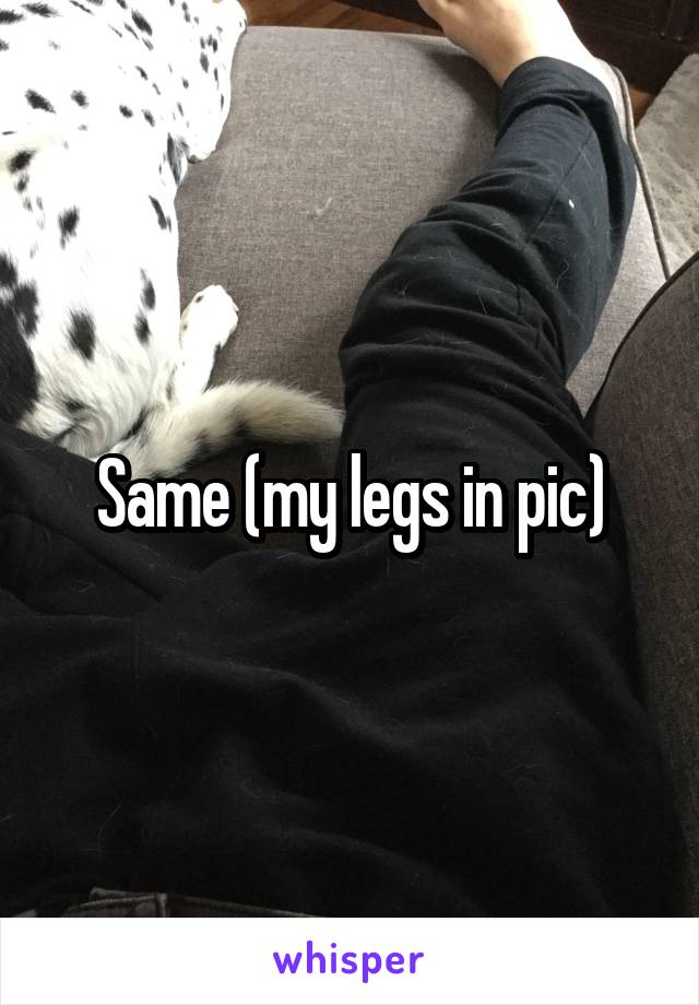 Same (my legs in pic)