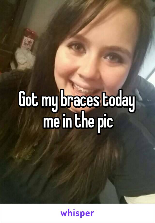 Got my braces today 
me in the pic