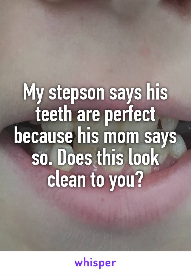 My stepson says his teeth are perfect because his mom says so. Does this look clean to you?