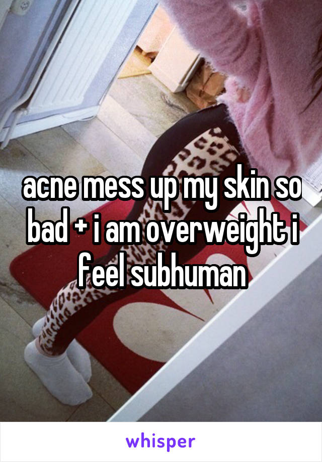 acne mess up my skin so bad + i am overweight i feel subhuman