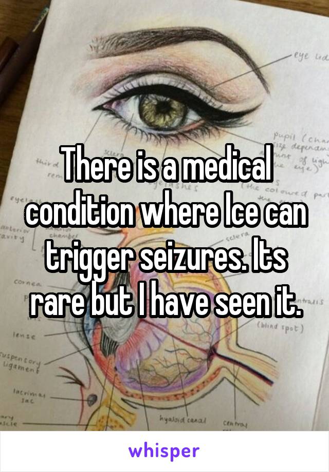 There is a medical condition where Ice can trigger seizures. Its rare but I have seen it.