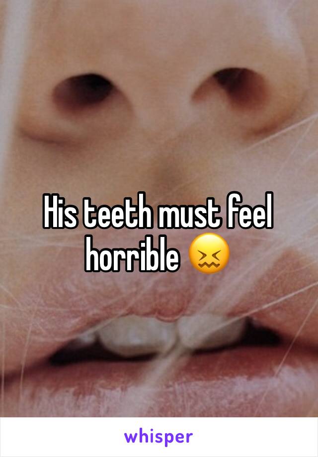 His teeth must feel horrible 😖