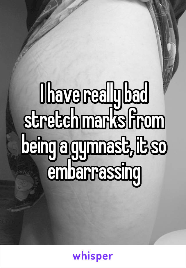 I have really bad stretch marks from being a gymnast, it so embarrassing