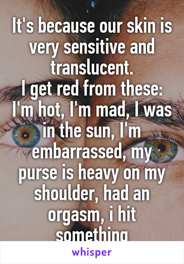 It's because our skin is very sensitive and translucent.
I get red from these: I'm hot, I'm mad, I was in the sun, I'm embarrassed, my purse is heavy on my shoulder, had an orgasm, i hit something