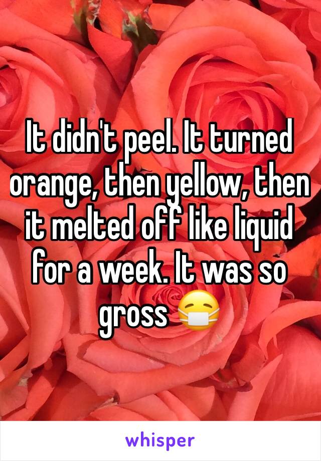 It didn't peel. It turned orange, then yellow, then it melted off like liquid for a week. It was so gross 😷