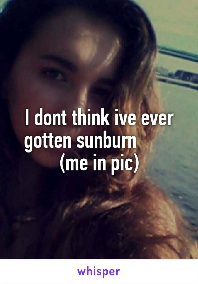 I dont think ive ever gotten sunburn         (me in pic)