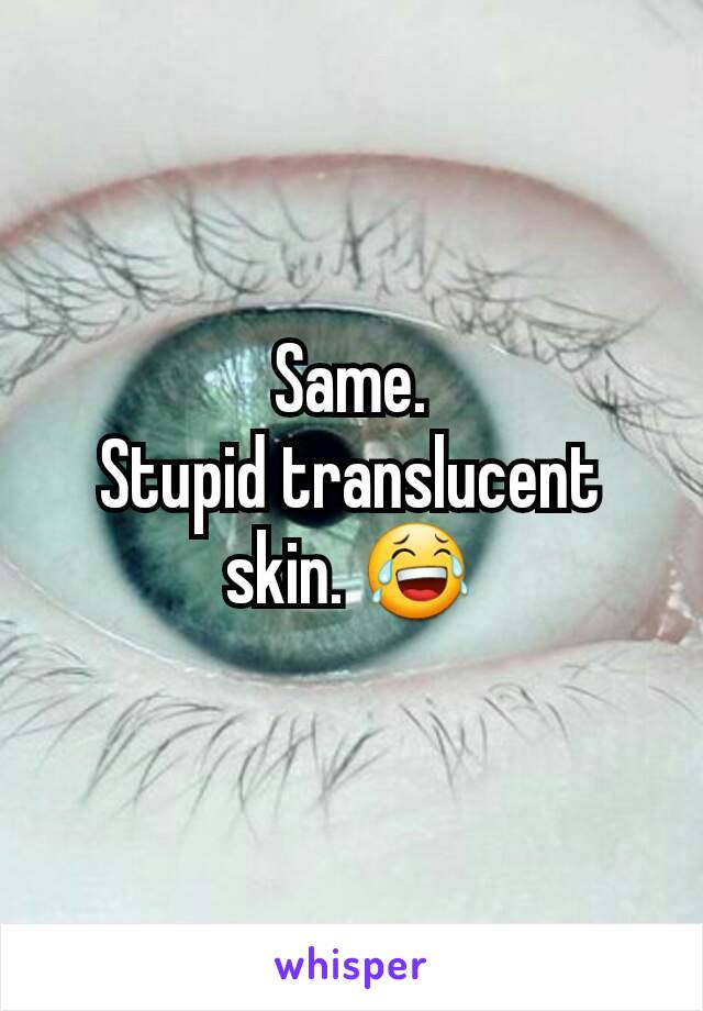 Same.
Stupid translucent skin. 😂