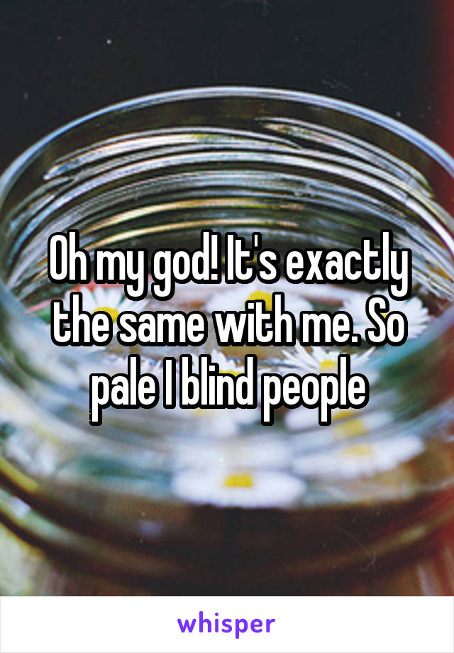 Oh my god! It's exactly the same with me. So pale I blind people
