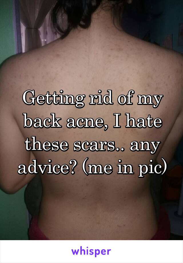 Getting rid of my back acne, I hate these scars.. any advice? (me in pic)