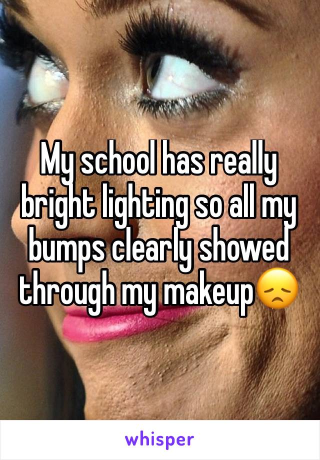 My school has really bright lighting so all my bumps clearly showed through my makeup😞