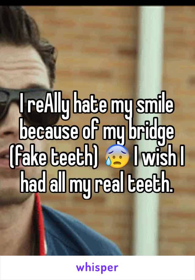 I reAlly hate my smile because of my bridge (fake teeth) 😰 I wish I had all my real teeth.