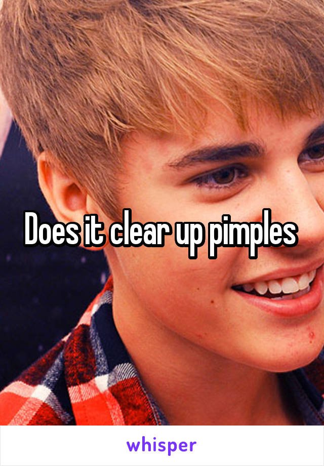 Does it clear up pimples 