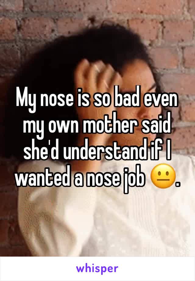 My nose is so bad even my own mother said she'd understand if I wanted a nose job 😐. 
