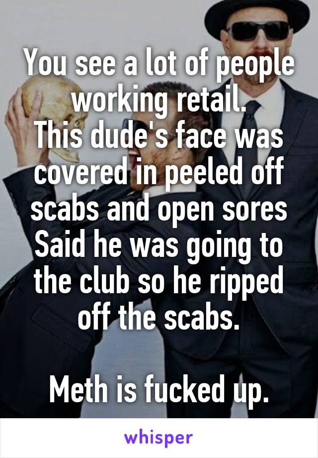 You see a lot of people working retail.
This dude's face was covered in peeled off scabs and open sores
Said he was going to the club so he ripped off the scabs.

Meth is fucked up.