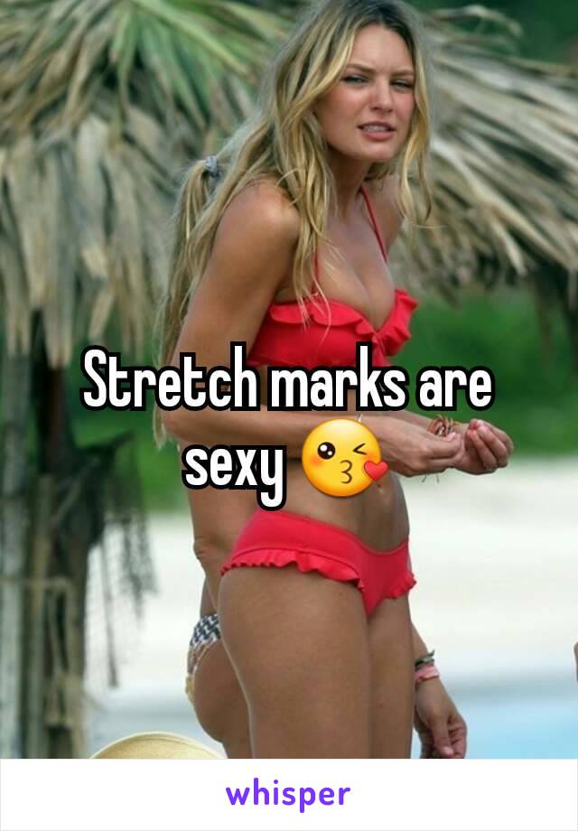 Stretch marks are sexy 😘