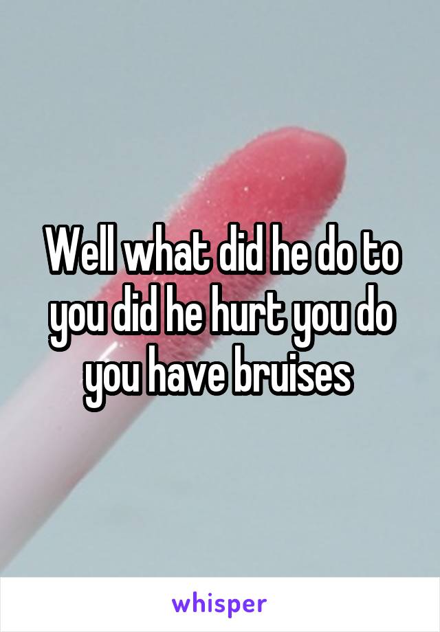 Well what did he do to you did he hurt you do you have bruises 