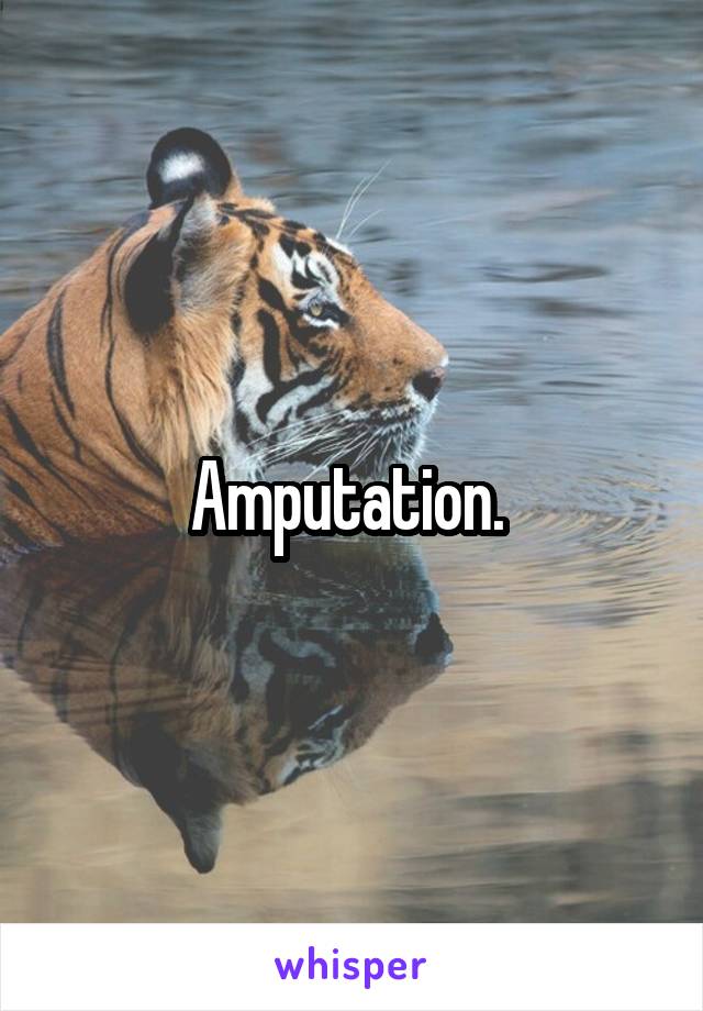 Amputation. 