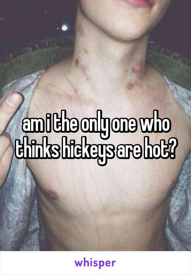 am i the only one who thinks hickeys are hot?