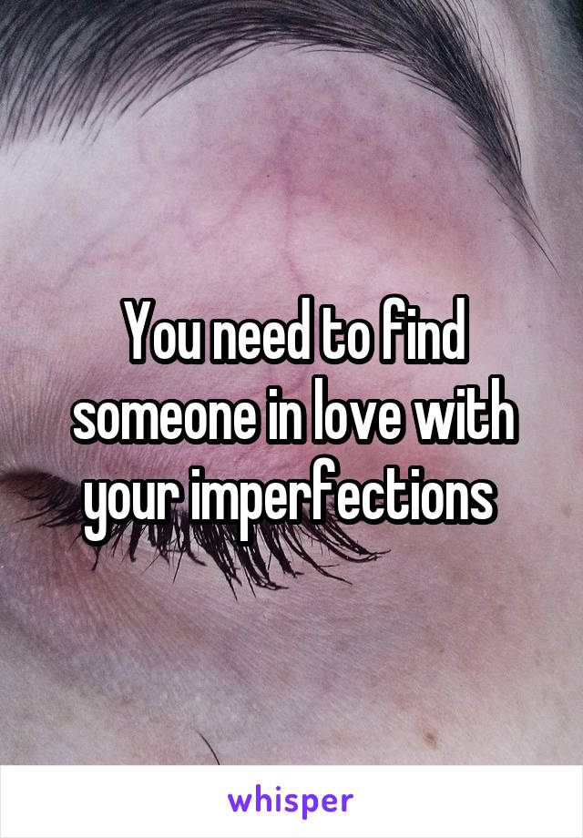 You need to find someone in love with your imperfections 