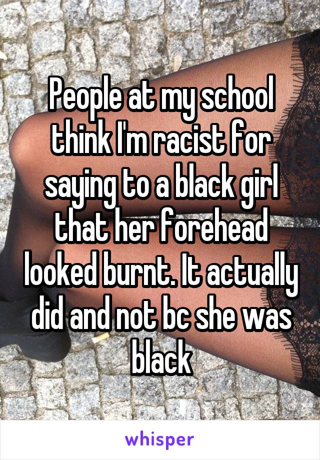 People at my school think I'm racist for saying to a black girl that her forehead looked burnt. It actually did and not bc she was black