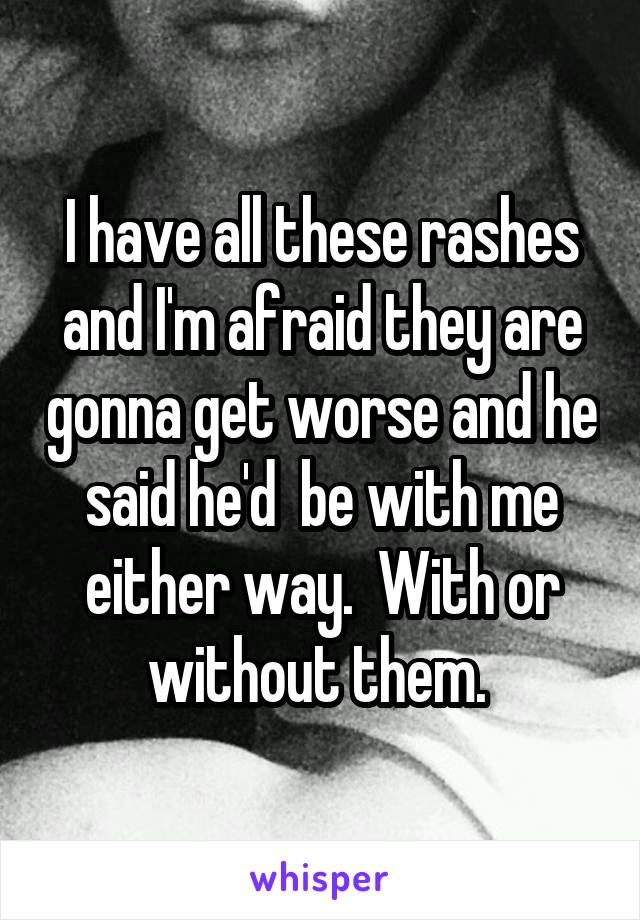 I have all these rashes and I'm afraid they are gonna get worse and he said he'd  be with me either way.  With or without them. 