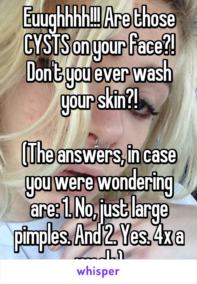 Euughhhh!!! Are those CYSTS on your face?! Don't you ever wash your skin?!

(The answers, in case you were wondering are: 1. No, just large pimples. And 2. Yes. 4x a week.)