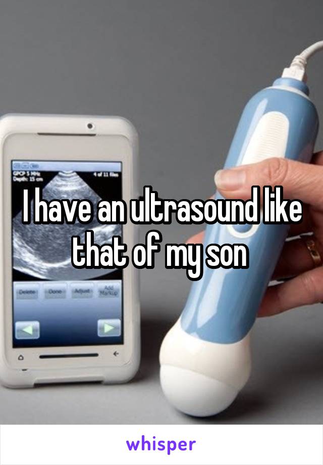 I have an ultrasound like that of my son 