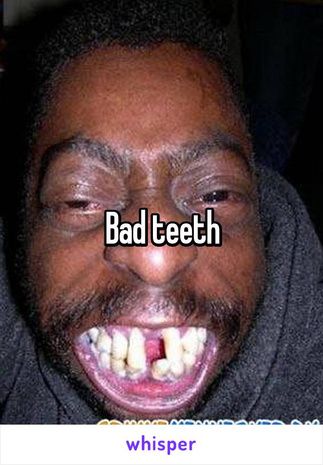 Bad teeth